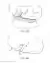 Fig. 10 - Refinement of an anatomical model using ultrasound