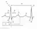 Fig. 01 - System and method of detecting abnormal movement of a physical object