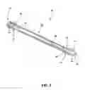 Fig. 04 - Intramedullary locked compression screw for stabilization and union of complex ankle and subtalar deformities