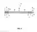 Fig. 05 - Intramedullary locked compression screw for stabilization and union of complex ankle and subtalar deformities