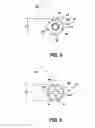 Fig. 06 - Intramedullary locked compression screw for stabilization and union of complex ankle and subtalar deformities