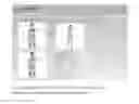 Fig. 05 - Preempt Muscle Map Screen