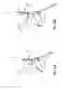 Fig. 14 - Cervical collar with independent height and circumference adjustability