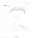 Fig. 09 - INTRAOCULAR SHUNTS