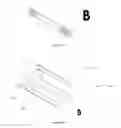 Fig. 10 - INTRAOCULAR SHUNTS
