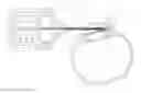 Fig. 01 - Systems for deploying intraocular shunts