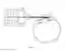 Fig. 09 - Devices and methods for implanting a shunt in the suprachoroidal space