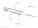 Fig. 16 - Devices and methods for implanting a shunt in the suprachoroidal space