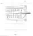 Fig. 23 - Devices and methods for implanting a shunt in the suprachoroidal space