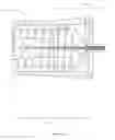 Fig. 30 - Devices and methods for implanting a shunt in the suprachoroidal space