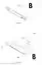 Fig. 42 - Devices and methods for implanting a shunt in the suprachoroidal space