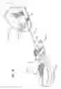 Fig. 04 - Dissection handpiece with aspiration means for reducing the appearance of cellulite