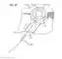 Fig. 18 - Dissection handpiece with aspiration means for reducing the appearance of cellulite