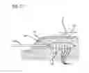 Fig. 26 - Dissection handpiece with aspiration means for reducing the appearance of cellulite
