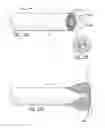 Fig. 30 - Dissection handpiece with aspiration means for reducing the appearance of cellulite