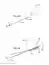 Fig. 33 - Dissection handpiece with aspiration means for reducing the appearance of cellulite