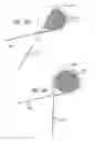 Fig. 34 - Dissection handpiece with aspiration means for reducing the appearance of cellulite