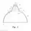 Fig. 04 - Breastfeeding shield