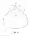 Fig. 05 - Breastfeeding shield