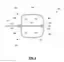 Fig. 04 - BALLOON CATHETER COMPRISING A ZERO-PROFILE TIP