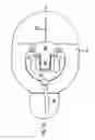 Fig. 03 - MEDICATION INFUSION SET
