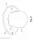 Fig. 13 - DEVICES AND METHODS FOR MAINTAINING AN ASEPTIC CATHETER ENVIRONMENT