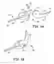 Fig. 04 - DRUG ELUTING IMPLANT