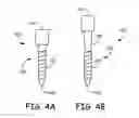Fig. 05 - DRUG ELUTING IMPLANT