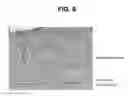 Fig. 08 - Activation of bone and cartilage formation