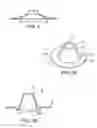 Fig. 03 - Ostomy barrier seal
