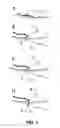 Fig. 02 - Sanitary Napkin with Braid