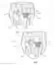 Fig. 02 - Absorbent Articles With Multiple Active Graphics