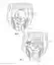 Fig. 04 - Absorbent Articles With Multiple Active Graphics