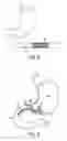 Fig. 05 - Pill Catchers