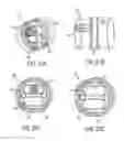 Fig. 29 - Pill Catchers