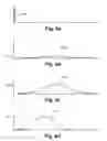 Fig. 05 - DEVICE FOR TREATING EYE TISSUE