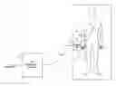 Fig. 01 - Electrosurgical medical system and method