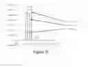 Fig. 07 - Pulsed power laser actuated catheter system for interventional oncology