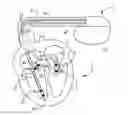 Fig. 01 - Implanted device data to guide ablation therapy