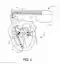 Fig. 02 - Implanted device data to guide ablation therapy