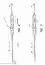 Fig. 03 - Methods of using a catheter having a braided conductive member