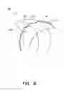Fig. 08 - Methods of using a catheter having a braided conductive member