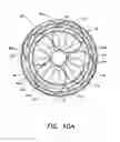 Fig. 10 - Methods of using a catheter having a braided conductive member