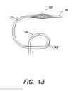 Fig. 12 - Methods of using a catheter having a braided conductive member