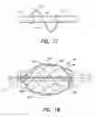 Fig. 16 - Methods of using a catheter having a braided conductive member