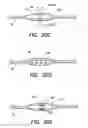 Fig. 19 - Methods of using a catheter having a braided conductive member