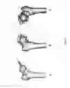 Fig. 05 - Surgical guiding tool, methods for manufacture and uses thereof