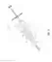 Fig. 06 - Injector for intraocular lens system