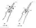 Fig. 04 - CIRC CLIP