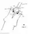 Fig. 05 - CIRC CLIP